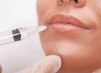 Alles over de lip flip behandeling: wat je moet weten news-19092024-220623